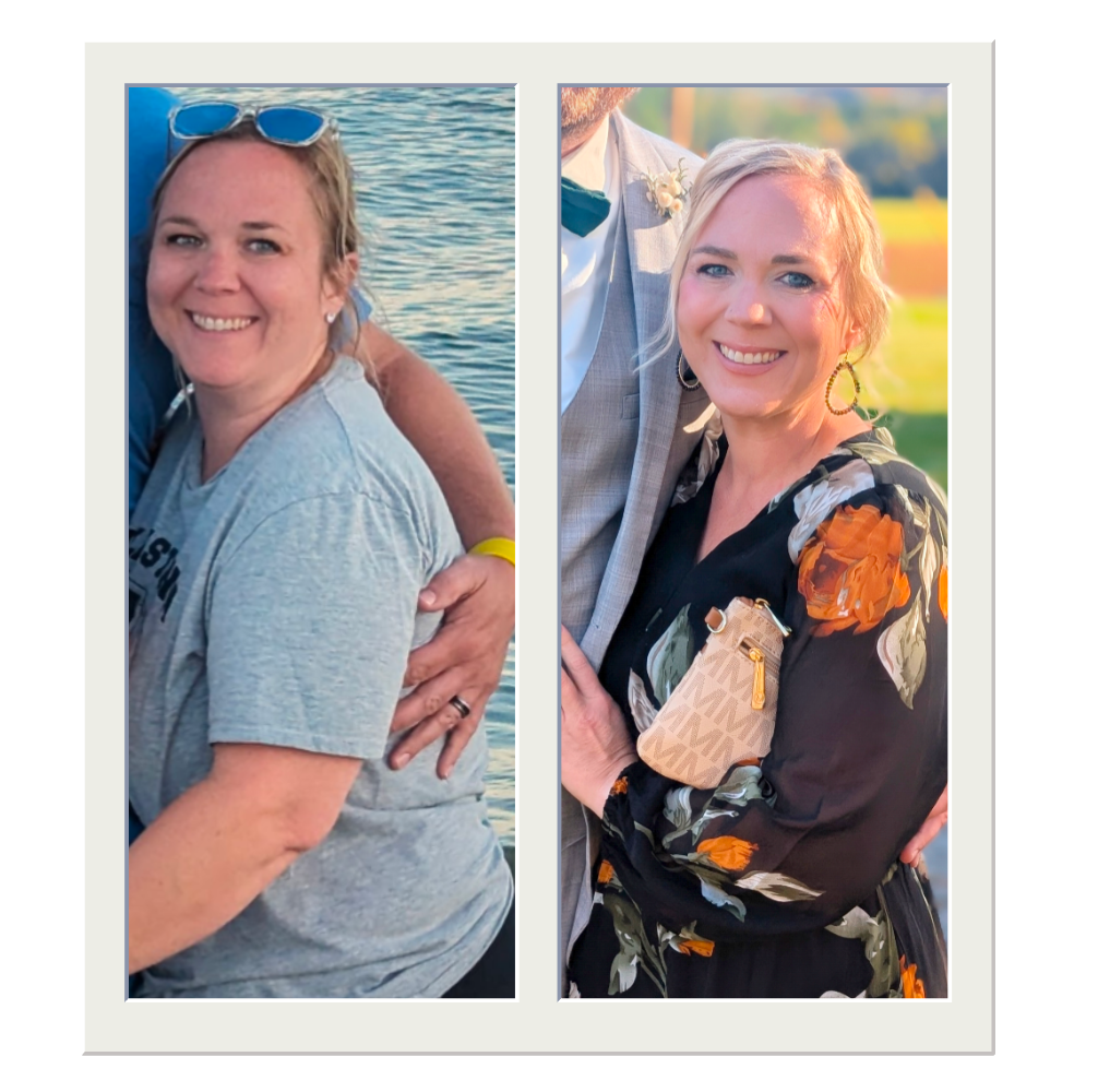 Weight Loss Services image 2