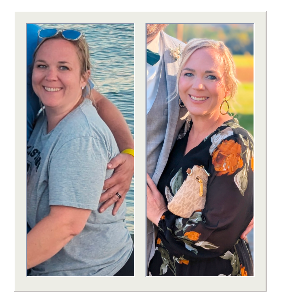 Weight Loss Services image 2